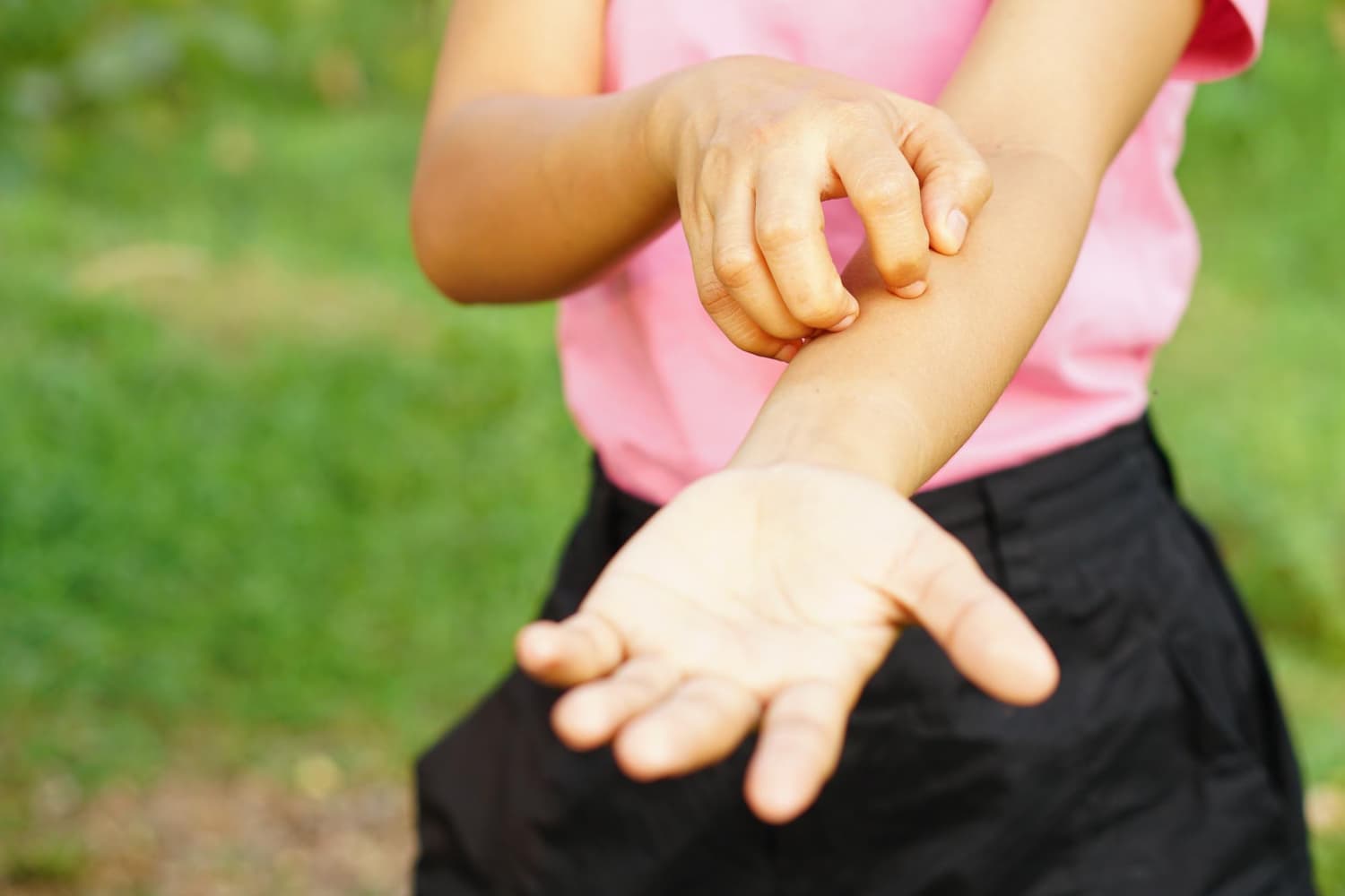 Infecciones por hongos en niños