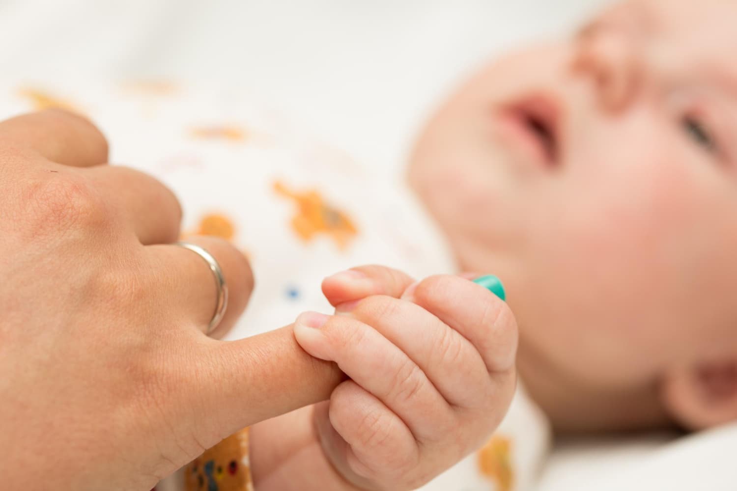 Nevus Congénitos y Lesiones de Nacimiento