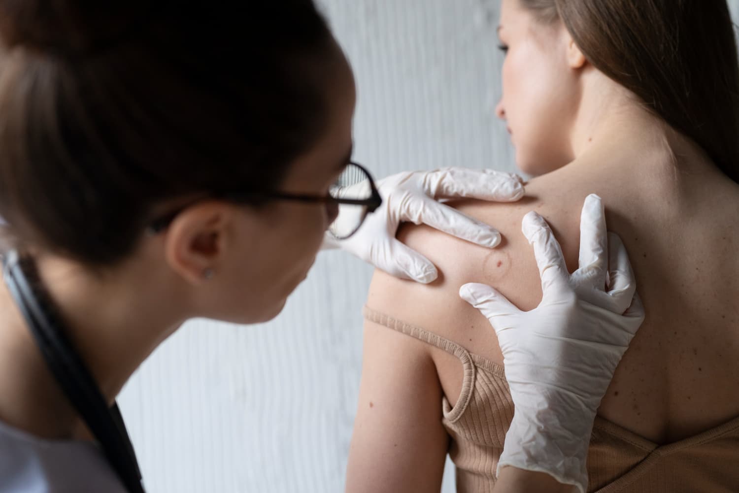 Queratosis Actínicas y Cáncer de Piel
